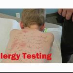 Pediatric Food Allergies 9-26-17