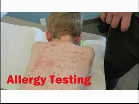 Pediatric Food Allergies 9-26-17