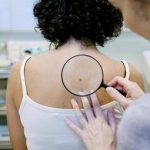 Dermatologists Host Free Skin Cancer Screening for the Public in Exeter Township