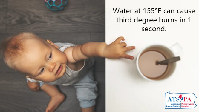 Burn Prevention Where You Live, Work, and Play